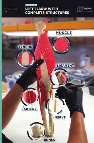 Elbow with Complete Structures