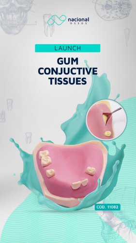Gum Conjuctive Tissues