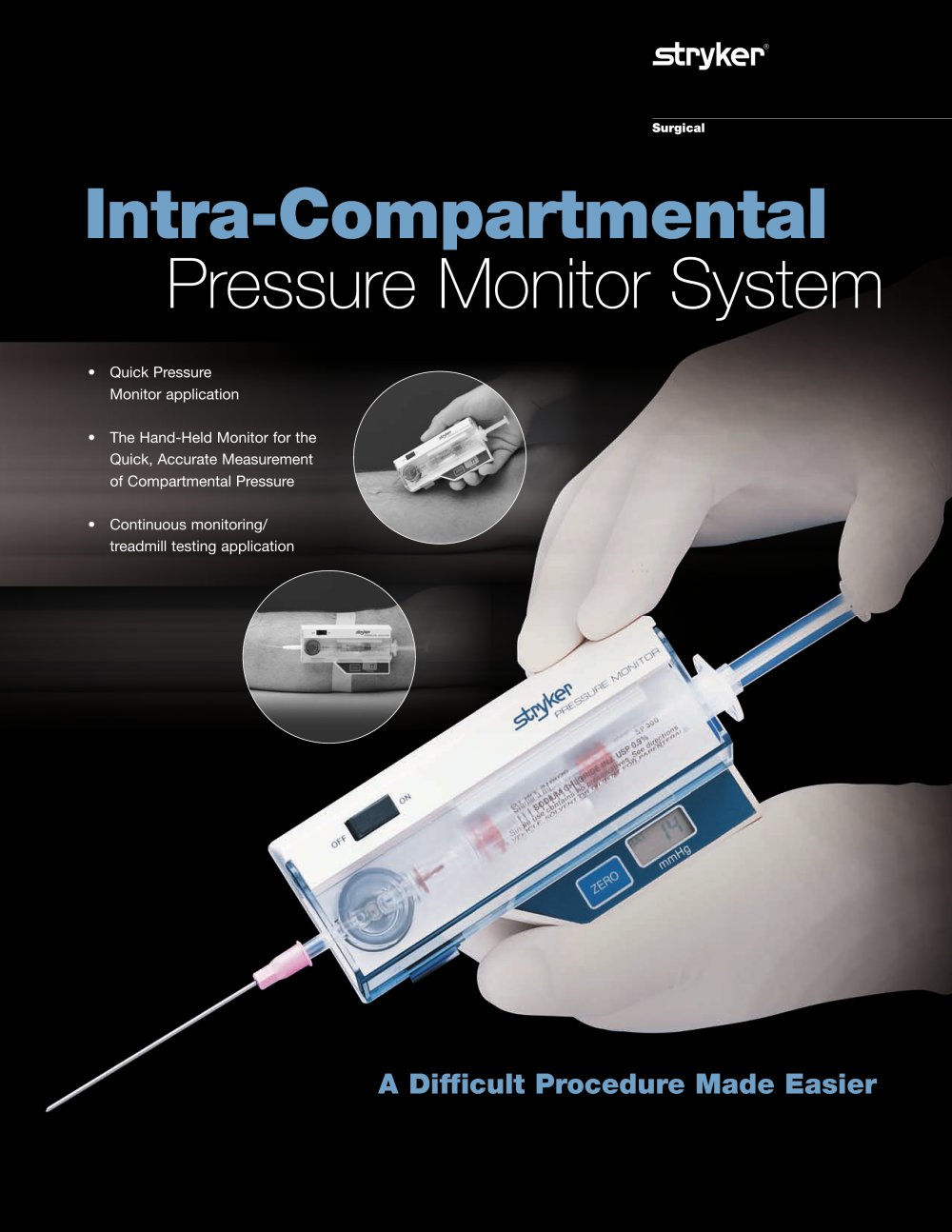 Intra-Compartmental Pressure Monitor - Stryker