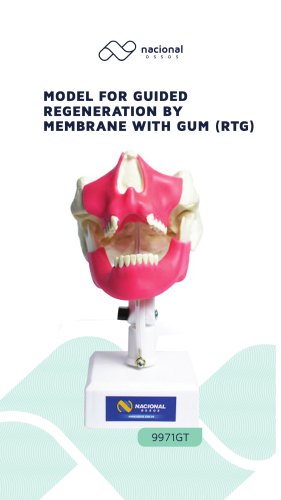 Model for Guided Regeneration by Membrane with Gum (RTG)
