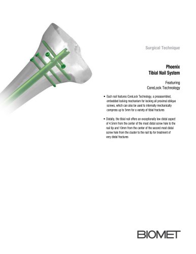 Phoenix Tibial Nail System Featuring CoreLock Technology Surgical Technique