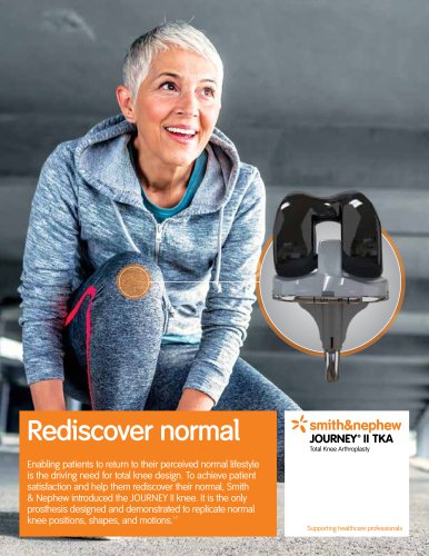 Rediscover normal