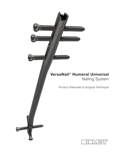 VersaNail&reg; Humeral Universal Nailing System Product Rationale & Surgical Technique