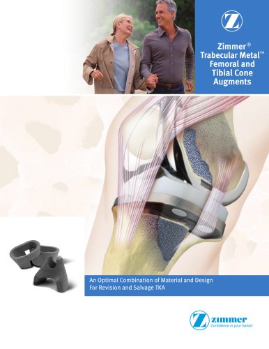 Zimmer&reg; Trabecular Metal? Femoral and Tibial Cone Augments